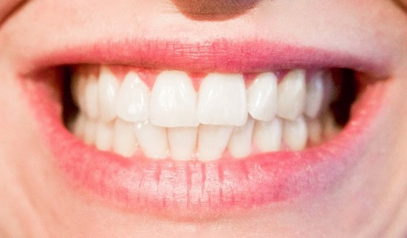 Implanty na Żoliborzu ceną za prawie naturalne zęby